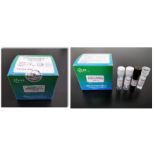 Anti Igg/Igm Rapid Test Kit for Human Nucleic Acid Detection Kit (Fluorescence RT-PCR) , Acid Test